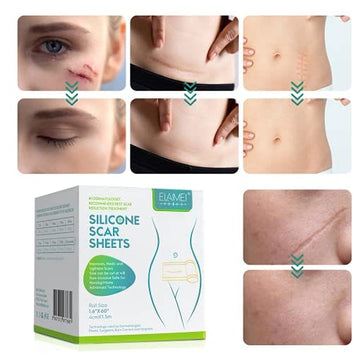 Dermoxy™ Scar Removal Tape